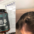 分享我調理一個月的成果：亞尼活力法倍多膠囊(生物素+MSM)
