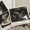 親愛的，I am pregnant‧‧‧我懷孕了