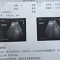 症狀好轉，我相信是好徵兆