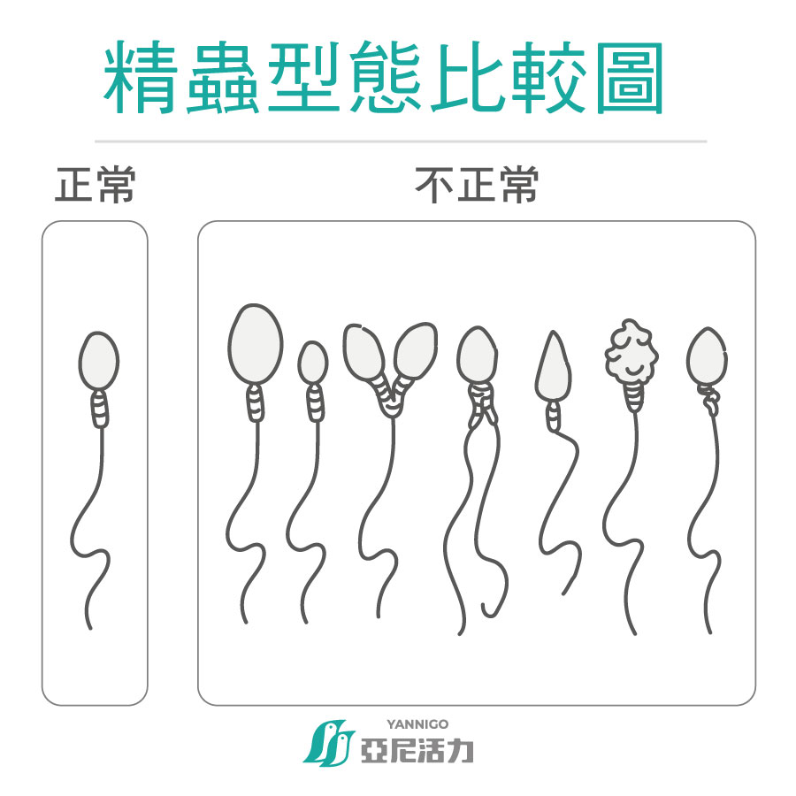 男性不孕精蟲型態異常比較圖